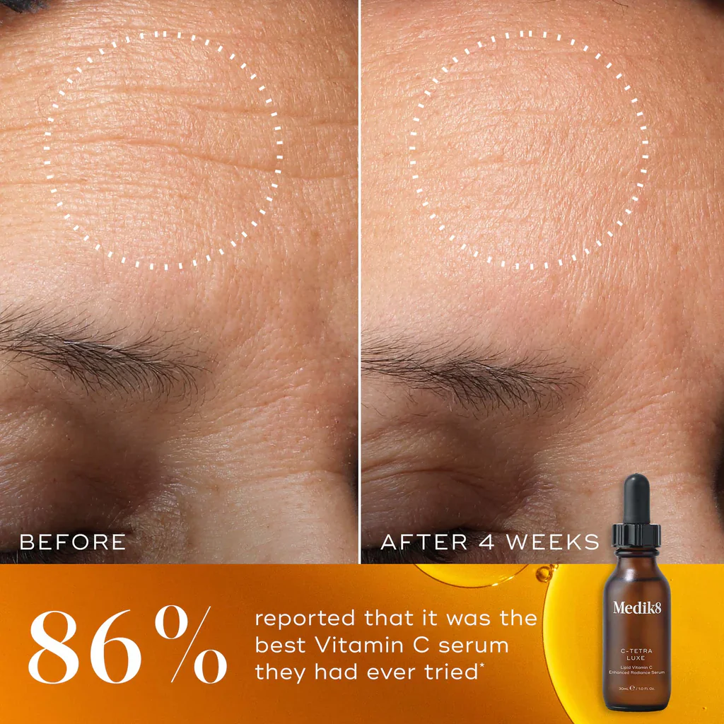 Medik8 C-Tetra® LUXE Serum - Image 3
