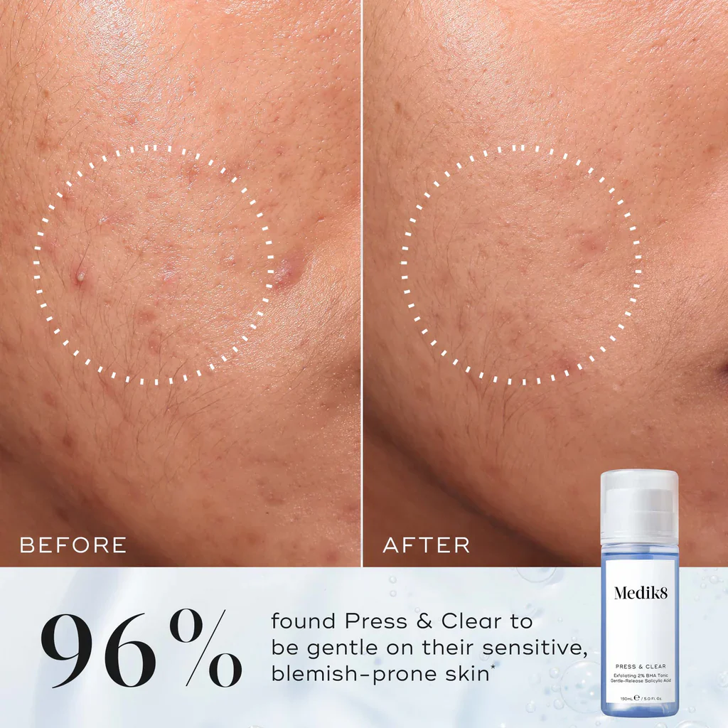 Medik8 Press & Clear™ Exfoliating BHA Toner – 2% Salicylic Acid, 150 ml - Image 3